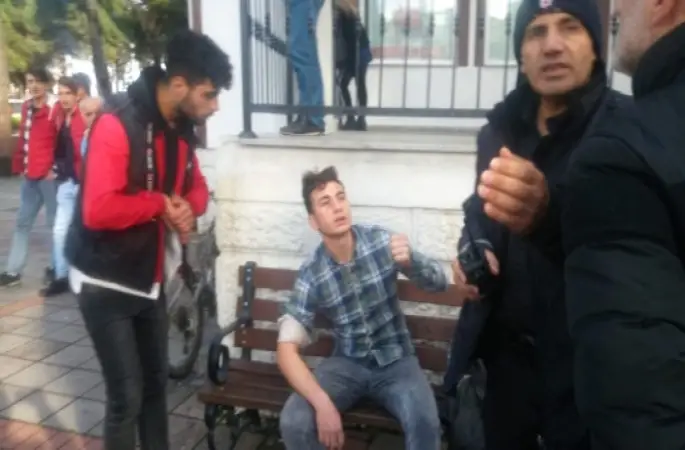 Sahibiyle Kavga Edeni Kolundan Isırdı