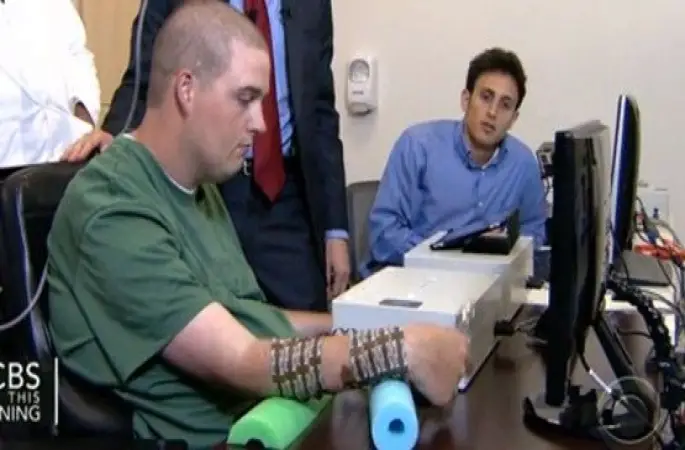 Düşünce Gücüyle Felçli Kolunu Oynattı