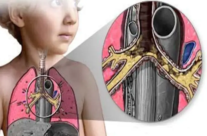 Bu hastalığı çocuğunuzu öperek de anlayabilirsiniz.