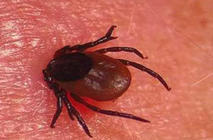 KKKA hastalığı şüphesiyle ölüm